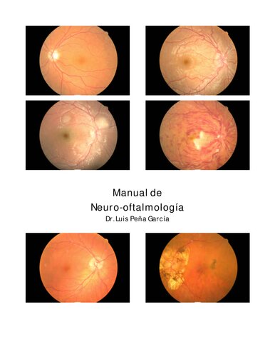 Manual de Neuro-oftalmología.PDF