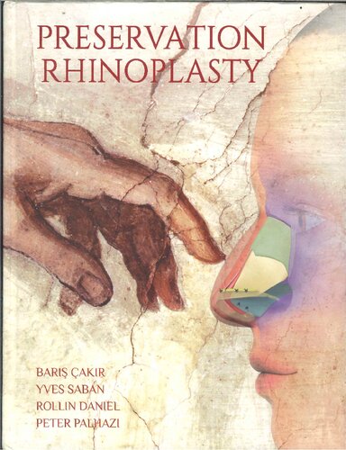 Preservation Rhinoplasty