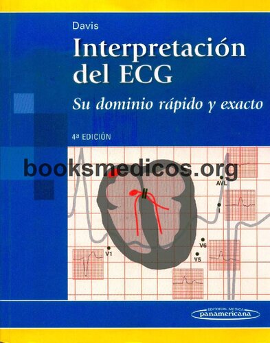 Interpretacion Del ECG