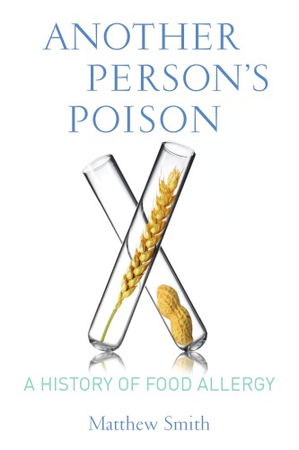 Another person's poison: a history of food allergy