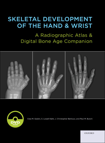 Skeletal development of the hand and wrist: a radiographic atlas and digital bone age companion