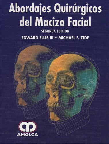 Abordajes Quirurgicos Del Macizo Facial (2ed)