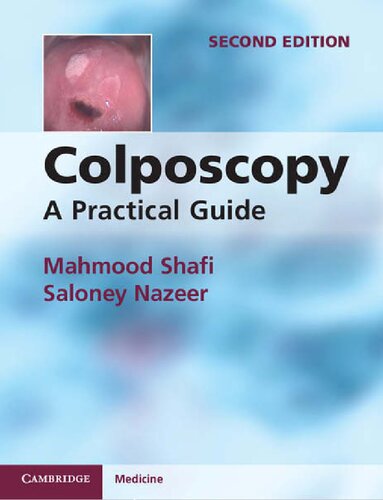 Colposcopy: A Practical Guide