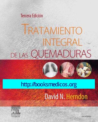 Tratamiento Integral De Las Quemaduras (3ed)