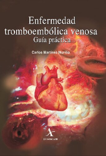 Enfermedad Tromboembolica Venosa