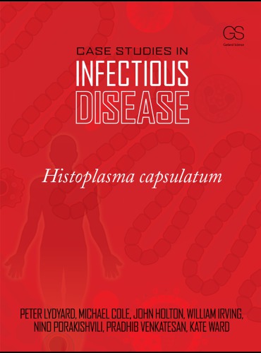 Case Studies in Infectious Disease: Histoplasma Capsulatum