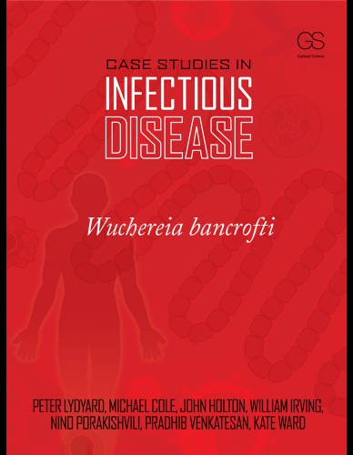 Case Studies in Infectious Disease: Wuchereria Bancrofti