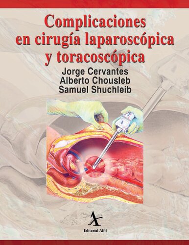 Complicaciones En Cirugia Laparoscopica Y Toracoscopica