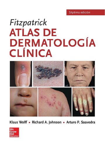 Fitzpatrick Atlas de dermatología clínica