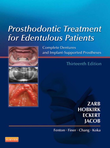 Prosthodontic Treatment for Edentulous Patients: Complete Dentures and Implant-Supported Prostheses