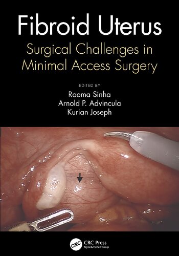 Fibroid Uterus: Surgical Challenges in Minimal Access Surgery