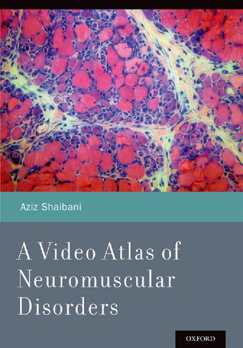 A Video Atlas of Neuromuscular Disorders