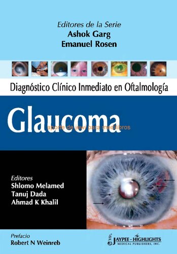 Diagnostico Clinico Inmediato En Oftalmologia