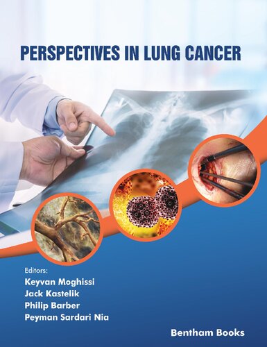 Perspectives in Lung Cancer