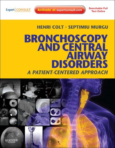 Bronchoscopy and Central Airway Disorders: A Patient-Centered Approach