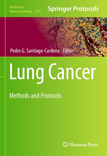 Lung Cancer: Methods and Protocols