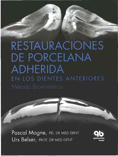 Restauraciones de porcelana adherida en los dientes anteriores : método biomimético