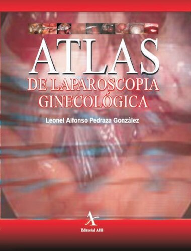 Atlas de laparoscopia ginecológica