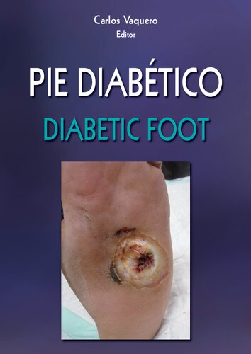 Pie diabético = Diabetic foot