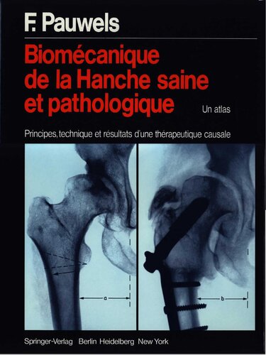 Biomecanique de la hanche saine et pathologique