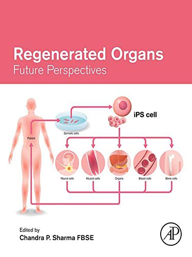 Regenerated Organs: Future Perspectives