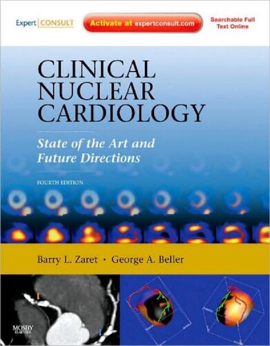 Clinical Nuclear Cardiology. State of the Art and Future Directions