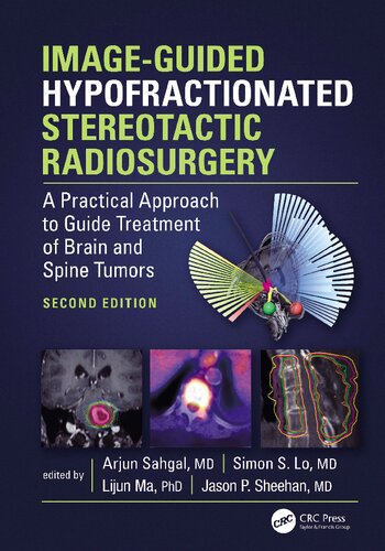 Image-Guided Hypofractionated Stereotactic Radiosurgery: A Practical Approach to Guide Treatment of Brain and Spine Tumors