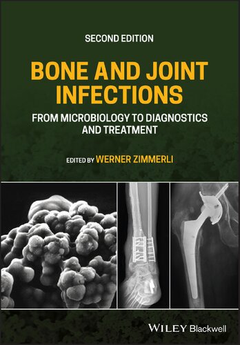 BONE AND JOINT INFECTIONS : from microbiology to diagnostics and treatment.