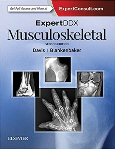 : Musculoskeletal