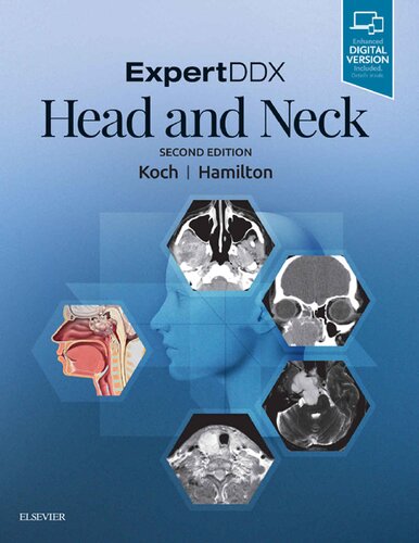 EXPERTDDX : Head and Neck.