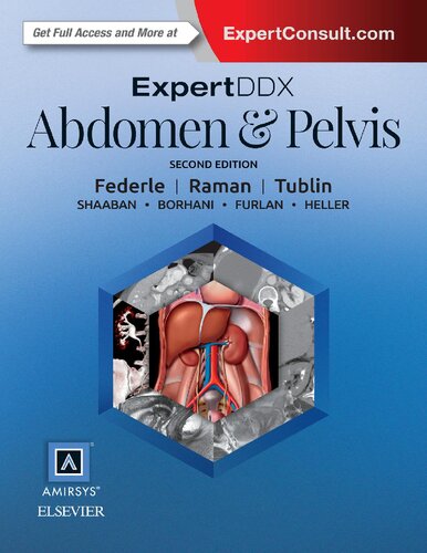 ExpertDDx: Abdomen and Pelvis