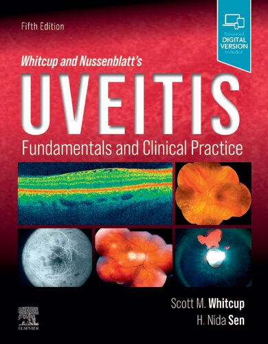 Whitcup and Nussenblatt's Uveitis: Fundamentals and Clinical Practice