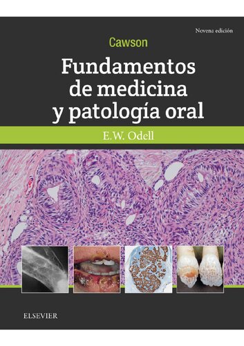 Cawson. Fundamentos de medicina y patología oral