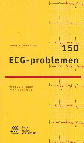 150 ECG-problemen