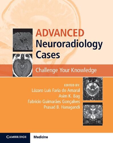 Advanced Neuroradiology Cases. Challenge Your Knowledge