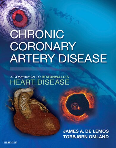 Chronic Coronary Artery Disease. A Companion to Braunwald's Heart Disease