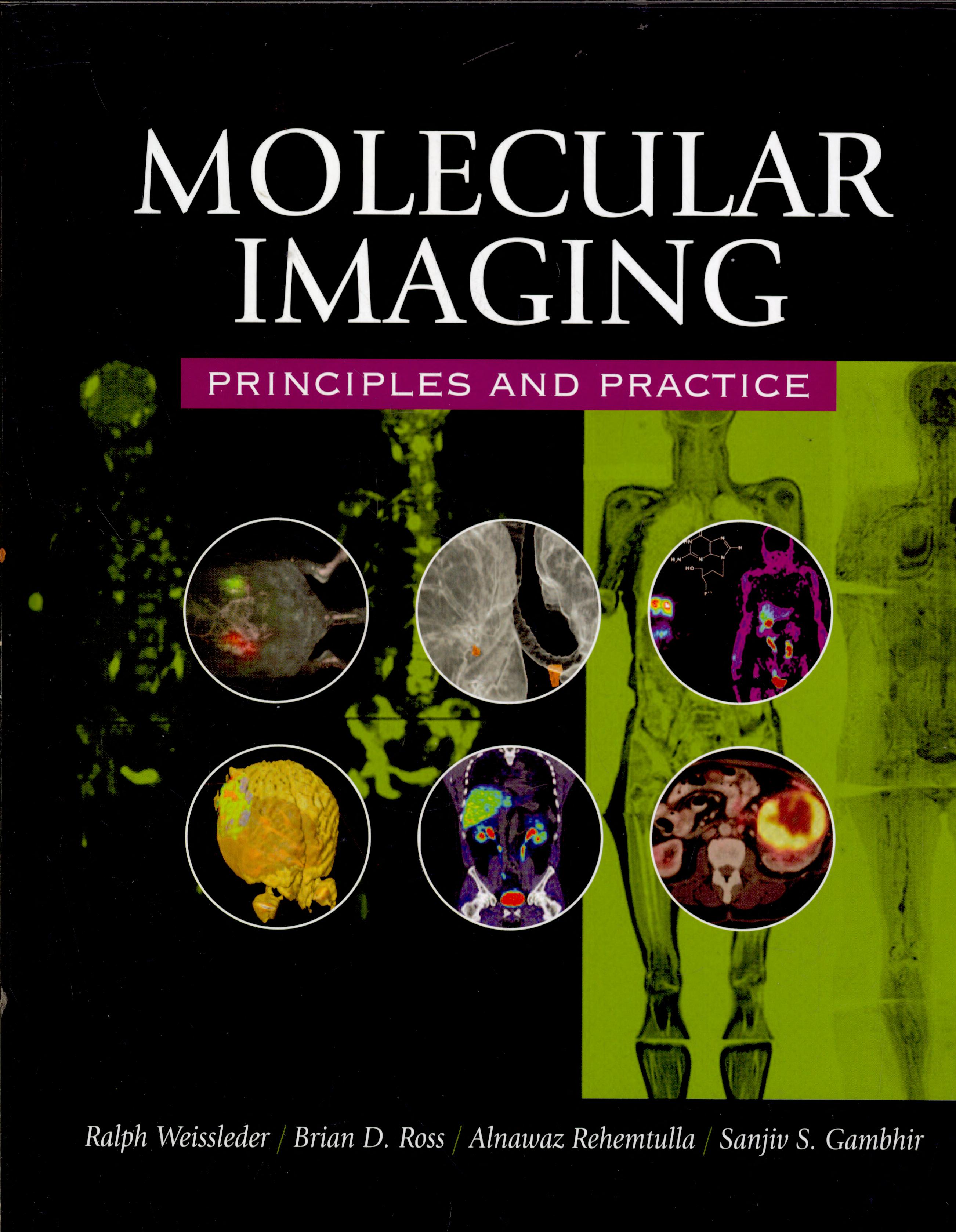 Molecular Imaging: Principles and Practice