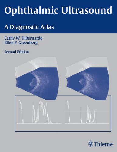 Ophthalmic Ultrasound: A Diagnostic Atlas