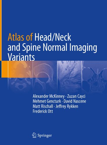 Atlas of Head/Neck and Spine Normal Imaging Variants