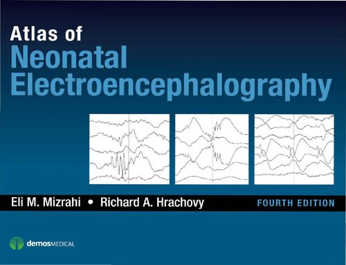 Atlas of neonatal electroencephalography