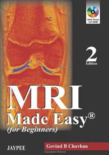 MRI Made Easy (for Beginners)