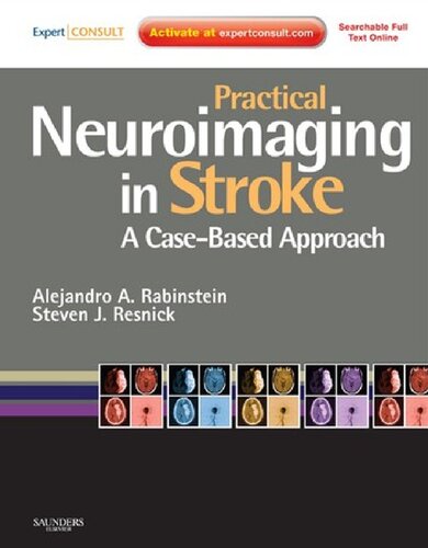 Practical Neuroimaging in Stroke: A Case-Based Approach