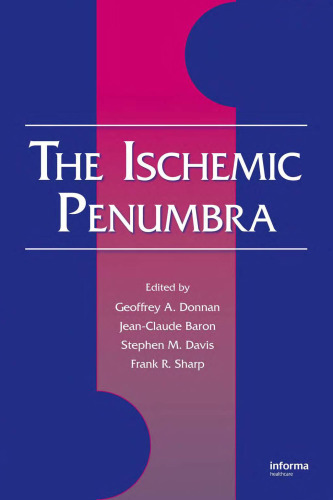 The Ischemic Penumbra ()