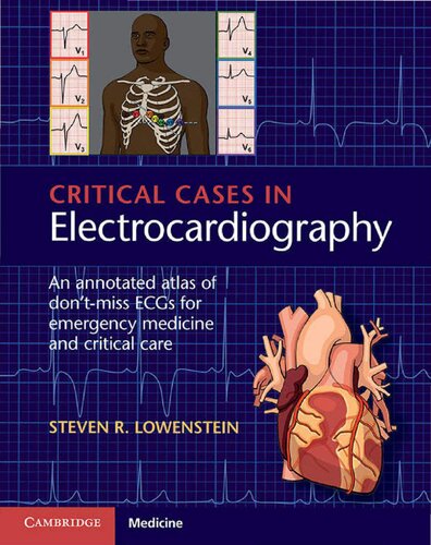 Critical Cases in Electrocardiography. An Annotated Atlas of Don’t-Miss ECGs for Emergency Medicine and Critical Care