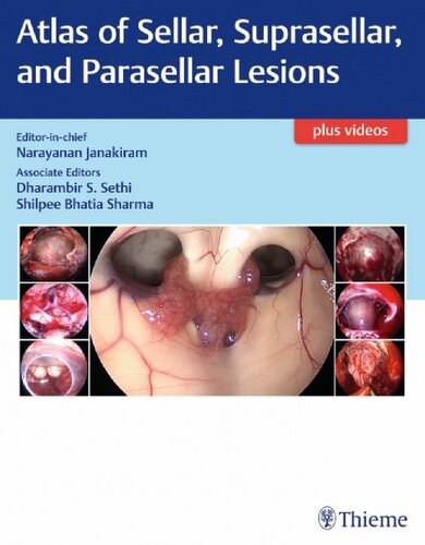 Atlas of Sellar, Suprasellar, and Parasellar Lesions