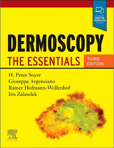 Dermoscopy the essentials