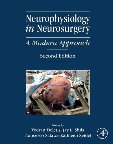 Neurophysiology in neurosurgery : a modern approach