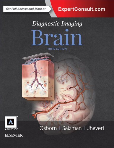 Diagnostic imaging : Brain