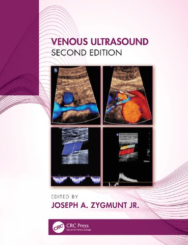 Venous ultrasound