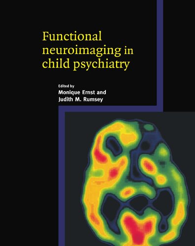 Functional neuroimaging in child psychiatry